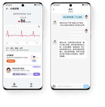 HUAWEI Watch D ECG 解读报告